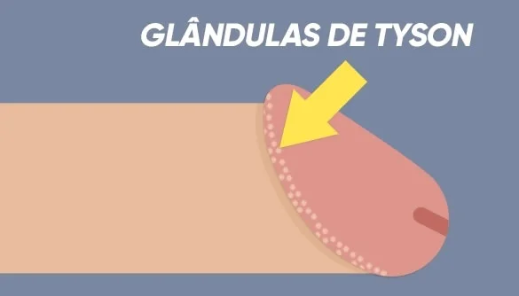 Bolinhas no pênis: Possíveis causas para esse bolinhas na cabeça do pênis 2 glandura de tyson bolinha na cabeça do penis