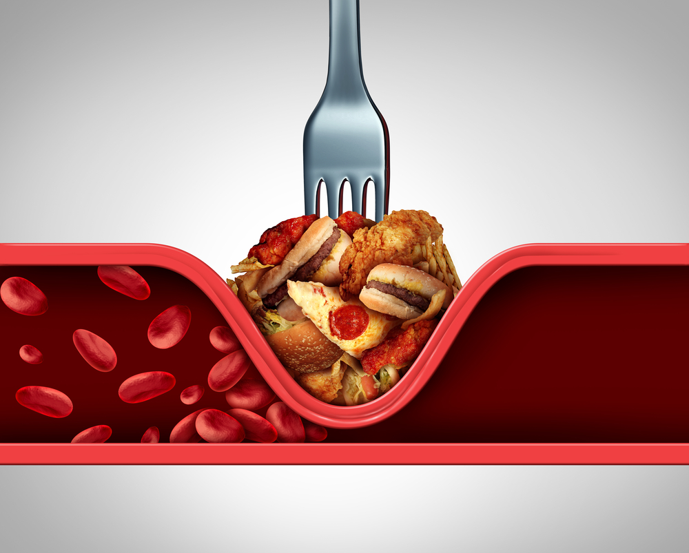 Alimentos para baixar colesterol