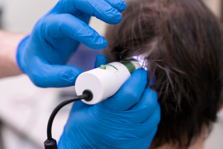 Cauterização capilar: o que é, para que serve e como é feita