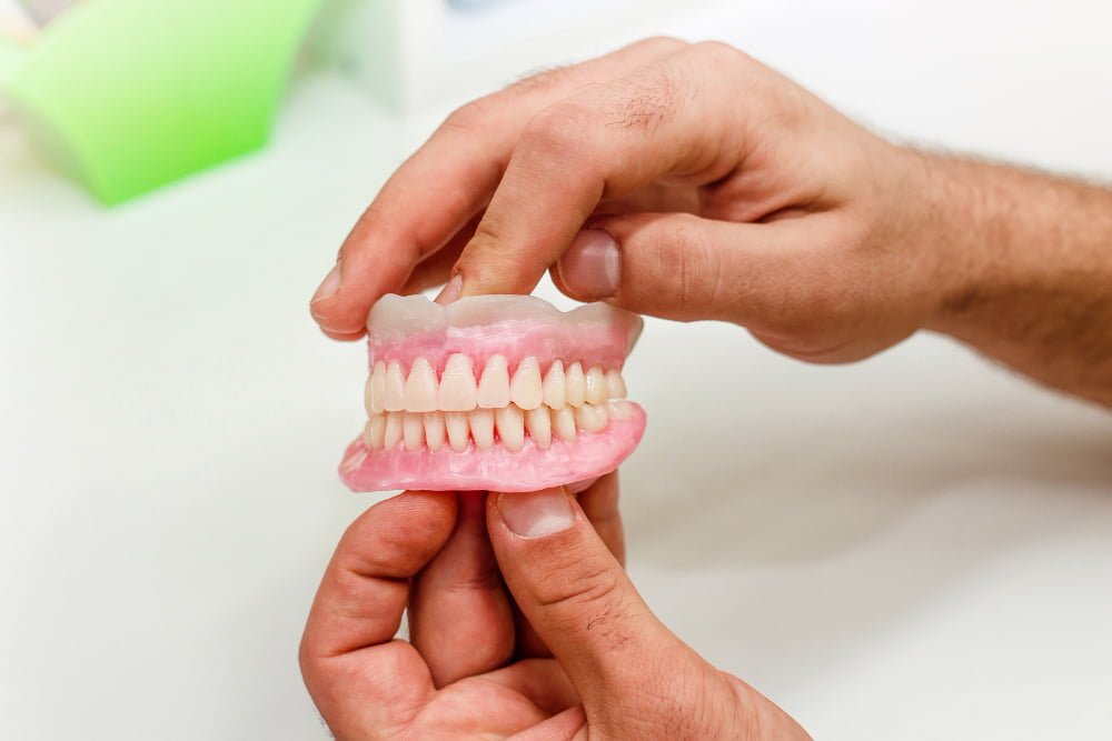 Implante dentário: o que é, quando é indicado e como é feito 6 Implante dentário: o que é, quando é indicado e como é feito 5